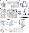 ZMYND8 inhibits ferroptosis in an NRF2-dependent manner.