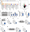 CIRBP binds Dhodh mRNA and enhances its translation.