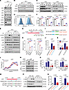 WTAP promotes the protein expression of proinflammatory genes through m6A m