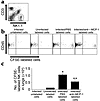 Role of MCP-1/CCL2 in in vivo recruitment of NK cells to the lungs in invas