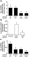 Role of CCR2 in in vivo recruitment of NK cells to the lungs in invasive as