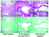 Effect of NK cell depletion or MCP-1/CCL2 neutralization on lung histology