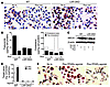 PPARα, but not PPARγ, agonists require LXR to reduce foam-cell formation in