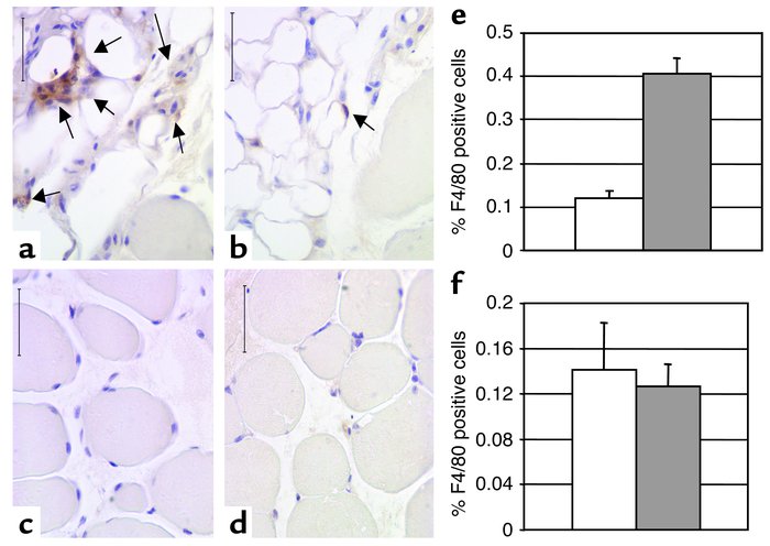 Macrophages in the liver and muscle of lean and obese mice. Immunohistoc...