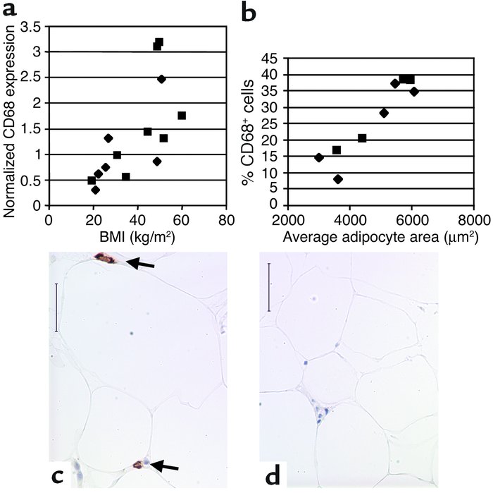 CD68 expression in human subcutaneous adipose tissue. Subcutaneous adipo...