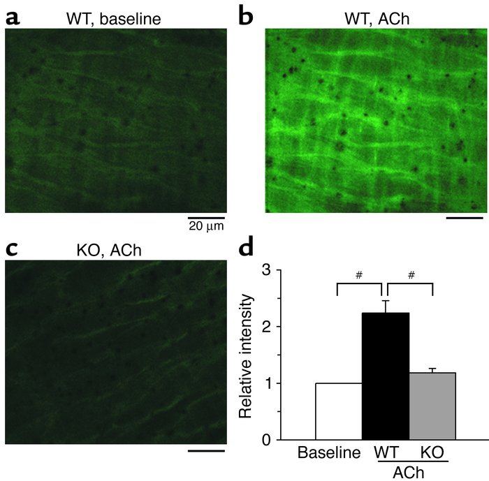 ACh-induced production of H2O2 by the endothelium. H2O2 production by th...