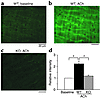 ACh-induced production of H2O2 by the endothelium. H2O2 production by the e