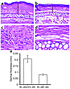 Minor histocompatibility antigen expression by the hematopoietic compartmen