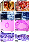 Aortic allografts from WT (A, C, E, and G) or GRKO (B, D, F, and H) recipie