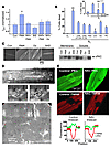 Mechanisms of protection. (A) MPT susceptibility to ROS (tMPT) can be regul