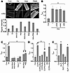 Distinct mechanisms of mitochondrial swelling_dependent and _independent pr