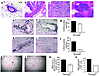 Beclin 1 heterozygous deletion alters cell-growth control in the mammary gl