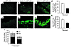 Beclin 1 heterozygous deletion decreases autophagy in muscle (a–d), bronchi