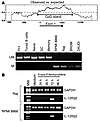 Methylation analysis of nepolastic B cells versus their normal counterparts