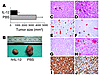 Tumorigenicity of IL-12Rβ2_transfected Raji cells in SCID-NOD mice. (A) The