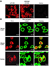 Subcellular localization of TLR2 in vitro. Monoclonal antibody T2.5 was use