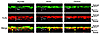 Surface colocalization of MyD88, IRAK-1, and TRAF6 with TLR2 confirmed by c