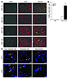 Cigarette smoke exposure causes lung cell apoptosis as assessed by TUNEL in