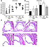 Disruption of Cd36 or Msr1 increases aortic sinus atherosclerosis in Apoe–/