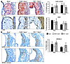 Immunohistochemical characterization of aortic sinus atherosclerosis. Aorti