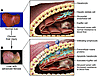 Changes in the hepatic architecture (A) associated with advanced hepatic fi