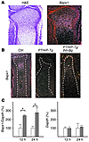 Hedgehog overactivation in periarticular chondrocytes stimulates differenti