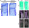 Growth plate elongation was induced by Ihh overexpression without upregulat