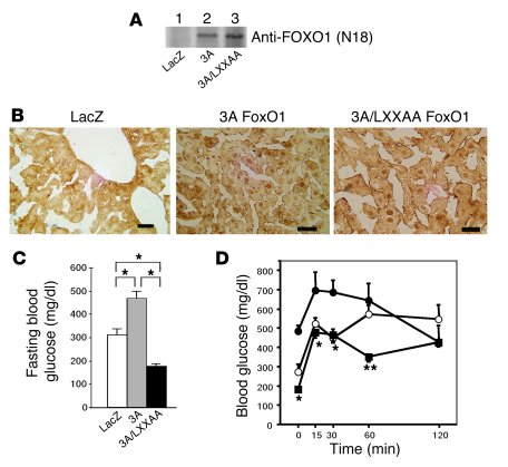 
                  Effects of overexpression of 3A/LXXAA FoxO1 on fasted...