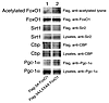 Acetylation of transduced FoxO1 in liver from Leprdb/db