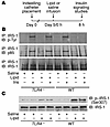 TLR4 deficiency prevents impaired insulin signaling in skeletal muscle caus