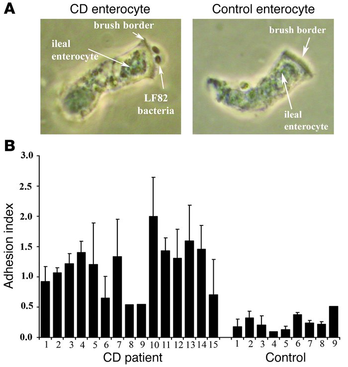 Adhesion of CD-associated AIEC strain LF82 to the brush border of ileal ...