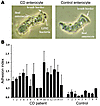 Adhesion of CD-associated AIEC strain LF82 to the brush border of ileal ent