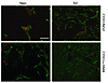 Effect of PDGF-BB overexpression on pericyte coverage.