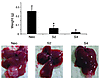 Effect of PDGF-BB overexpression on tumor growth in the liver.