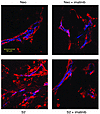 Effect of imatinib mesylate on pericyte coverage of HT-29 tumors.