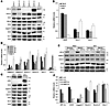 Notch signaling pathway components are expressed in CCRCC cells and maintai