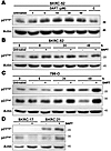 Notch inhibition of CCRCC cells results in elevation of p21Cip1 and/or p27K