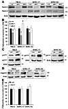 Ablation of endogenous Notch-1 by siRNA attenuates growth of CCRCC cells an