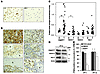 Notch pathway components are expressed in primary CCRCCs, and Notch inhibit