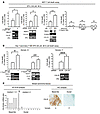 The IL-6/Notch-3/CA-IX axis promotes hypoxia survival.