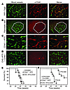 CD40 expression on tumor blood vessels.