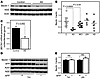 Beclin 1 is decreased in AD.