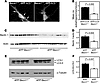 Beclin 1 and neuronal autophagy are reduced in Becn1+/– mice.