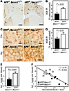 APP+Becn1+/– mice have increased amyloid pathology.