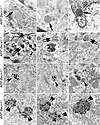 Abnormal lysosomes in APP+Becn1+/– mice.