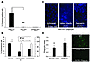 KIM-1 mediates phagocytosis of apoptotic necrotic cells but not other phago