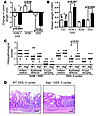 Aag–/– animals are more susceptible than Aag+/+ animals to DSS-induced coli