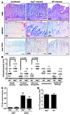 Increased severity of stomach pathology in Aag–/– versus Aag+/+ animals inf