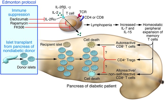 The immunologic consequences of islet transplantation under the Edmonton...