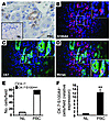 Bile ductular cells express the EMT marker S100A4 in patients with PBC.